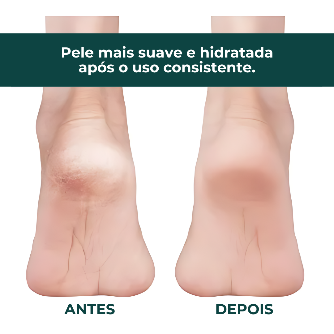 Meias de Silicone Gel Par Hidratação